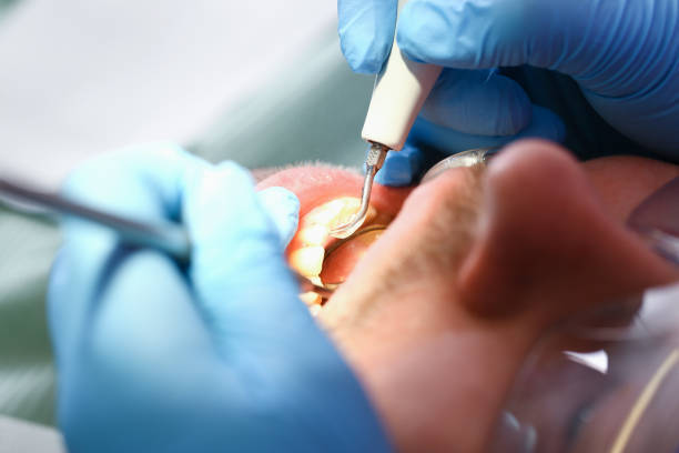 Best Holiday Emergency Dentist in Fort Irwin, CA