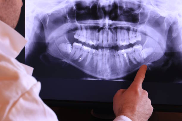 Best Weekend Emergency Dentist in Fort Irwin, CA