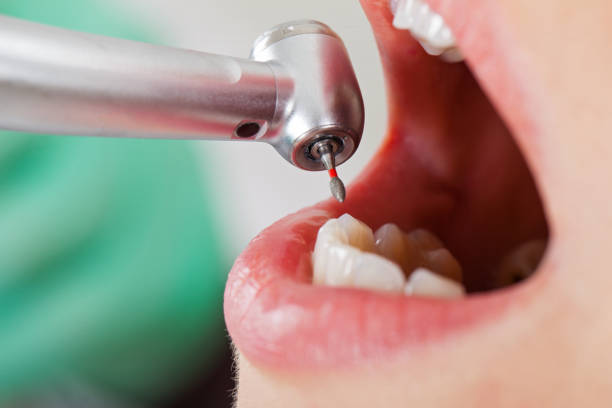 Best Mobile Emergency Dentist in Fort Irwin, CA